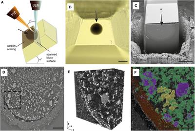 High-Resolution 3D Reconstruction of Human Oocytes Using Focused Ion Beam Scanning Electron Microscopy